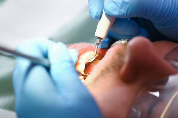 Best Broken or Chipped Tooth Repair in , TN